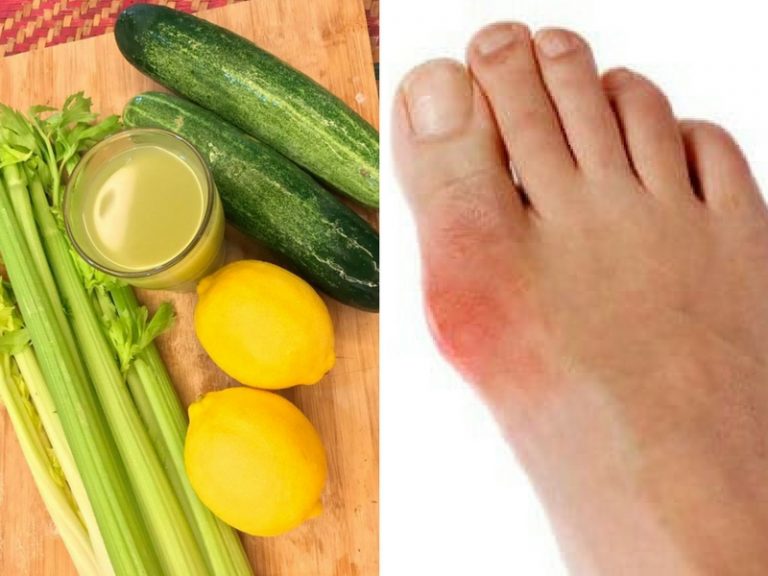 Cuba Petua Mudah Ini Untuk Yang Bermasalah Gout, Hanya Guna Tiga Bahan Dari Dapur Sahaja.
