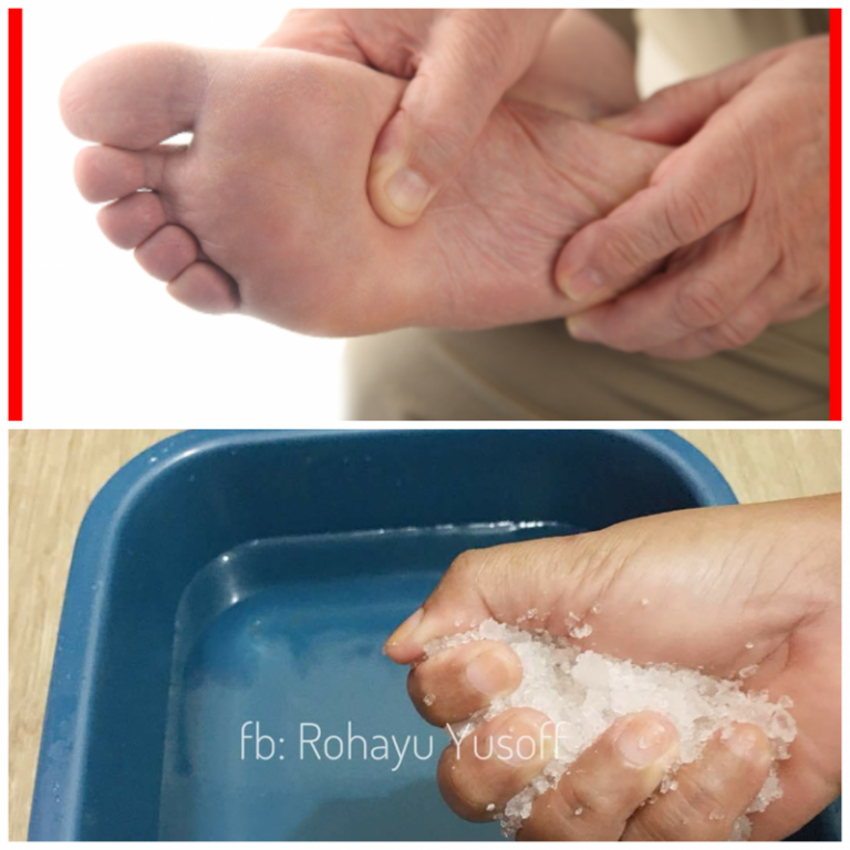Sengal Kaki Buat Ibu Ayah Tak Selesa. Redakan Segera Dengan Cara Mudah!