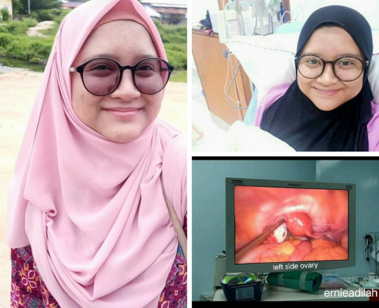 Period Tak Datang-datang, Rupanya Ovari Dipenuhi Cyst! Ikuti Perkongsian Wanita Ini.