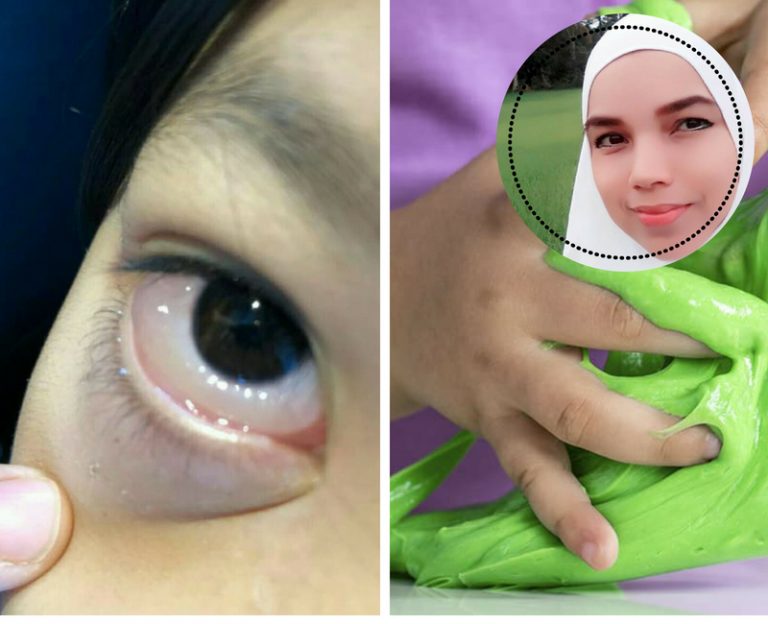 Baca Perkongsian Dari Mak Saudara Seorang Kanak-kanak Ni. Bermain Slime Rupanya Bahaya!
