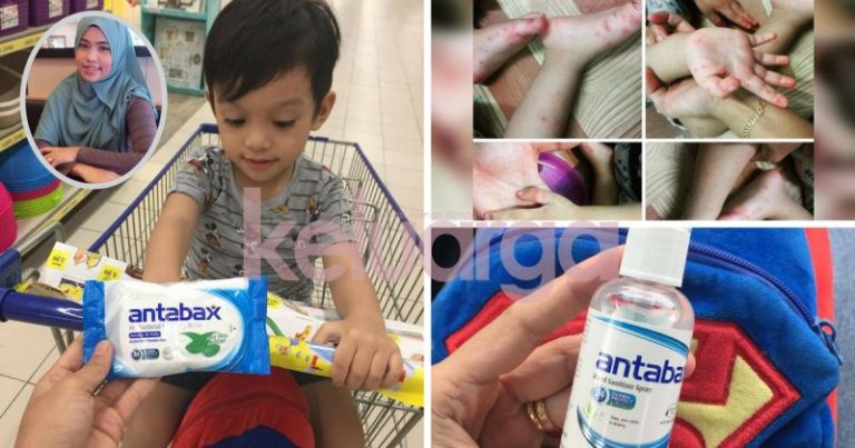 Fobia Anak Kena HFMD 3 Kali Berturut-Turut Dalam Masa 5 Bulan,  Wajib Sediakan Beg Kelengkapan Setiap Kali Keluar!