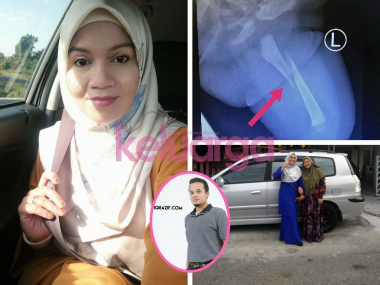 “Tangan Alin Patah Macam Dipiat. Banyak Lebam & Kesan Lain Di Kepala,”Kisah Anak Kena Dera Pengasuh.