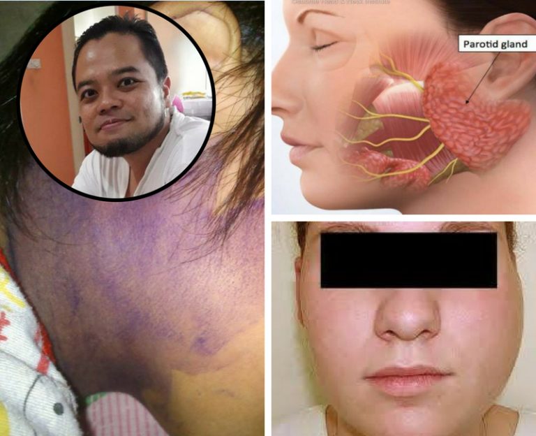 Ubat Beguk, Biasanya Kita Guna Nila. Dengar Apa Pula Kata Doktor Ni Tentang Tu.