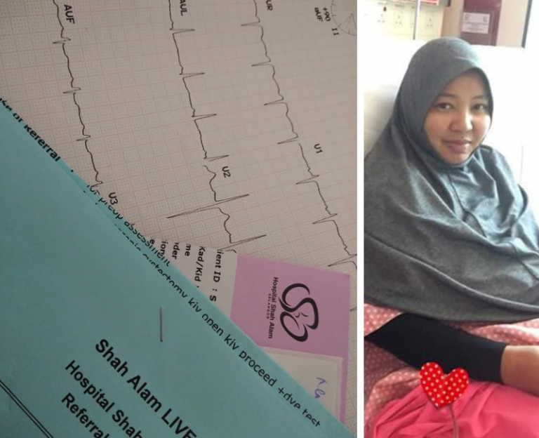 Ada Ketulan Besar Di Perut & Bila Ditekan Sakit, Disangka Angin Rupanya Cyst. Ibu Ni Kongsikan Deritanya!