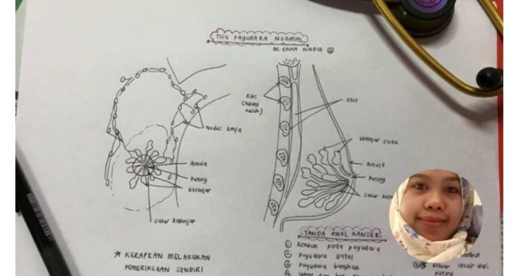 “Ketulan Itu Boleh Jadi Bahaya Atau Tidak Merbahaya.” Ambil Peduli Penjelasan Lengkap Doktor Ini Tentang Kanser Payudara