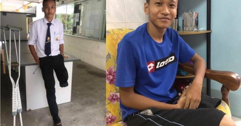 Rela Potong Kaki, Tak Mahu Menyusahakan Ibu Bapa. Sebak Kisah Pelajar Kanser Tulang Yang Bakal Duduki SPM Ini
