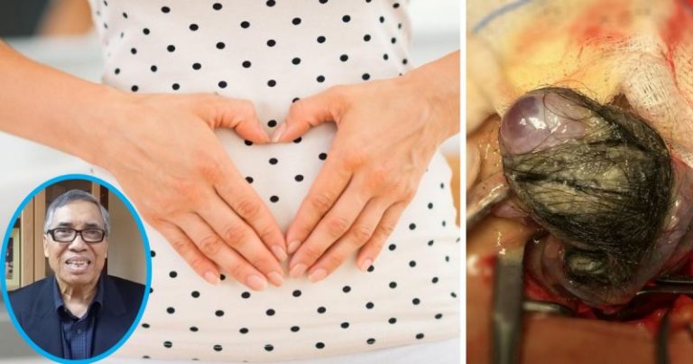 Masih Boleh Hamil Lepas Pembedahan Cyst, Dr Hamid Arshat Kongsi Tip Pemakanan Untuk Wanita. Yang Penting Amal Hidup Sihat!