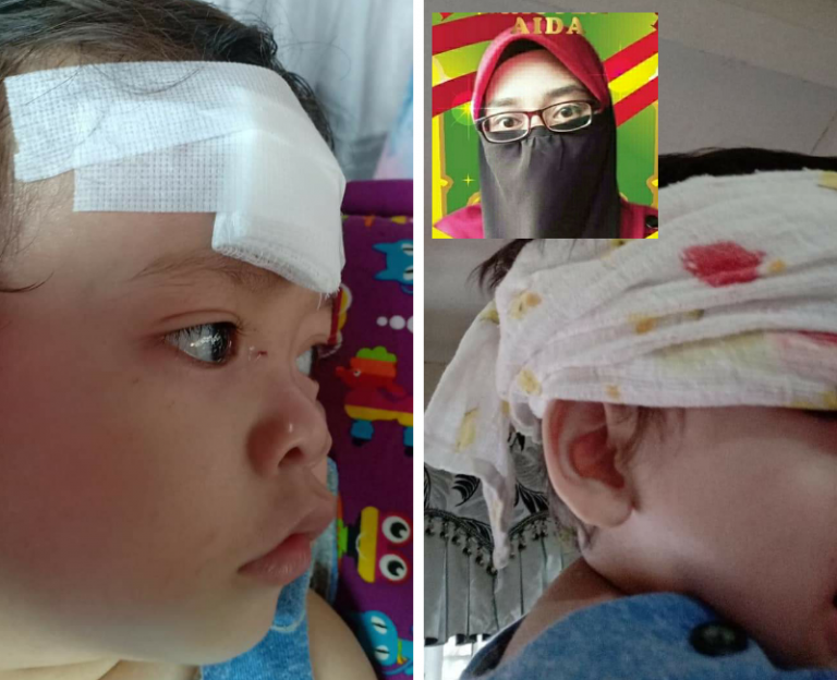 Situasi Cemas Bila Kepala Luka. Ibu Ni Kongsikan Pesanan Doktor Padanya!