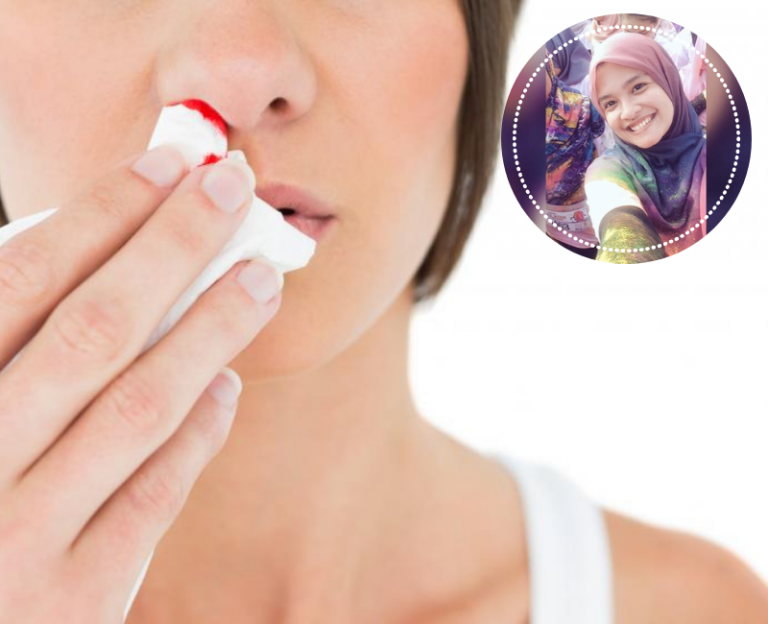 Hidung Berdarah, Doktor Sarankan Lakukan Cara Ni Segera & Jangan Mendongak. Bahaya Padahnya!