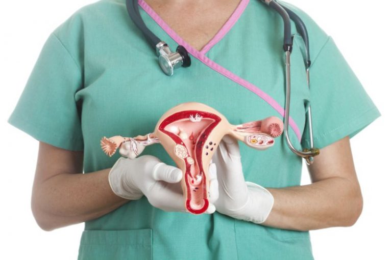 Elak Berlakunya Ketumbuhan Fibroid & Cyst Dalam Rahim, Ikut Langkah Ini. Paling Penting Jaga Makan!