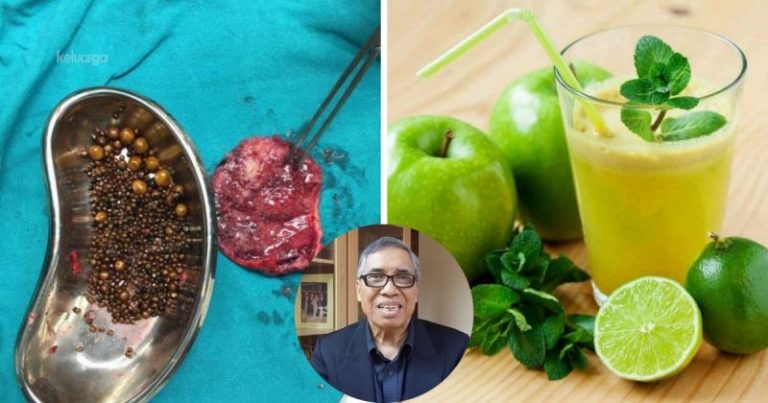 Dr Hamid Arshat Kongsi Petua & Cara Rawat Batu Karang Dalam Hempedu Secara Semula Jadi.