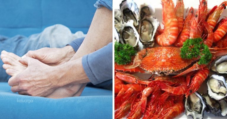 Jangan Salahkan Makanan Laut Sebagai Punca Gout.  Baca Perjelasan Dr Ni!