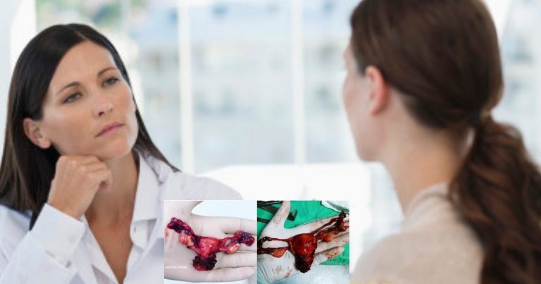 Berpada-Padalah Masa Berpantang, Jangan Sampai Jejaskan Rahim. Doktor Ini Jelaskan Sebabkan