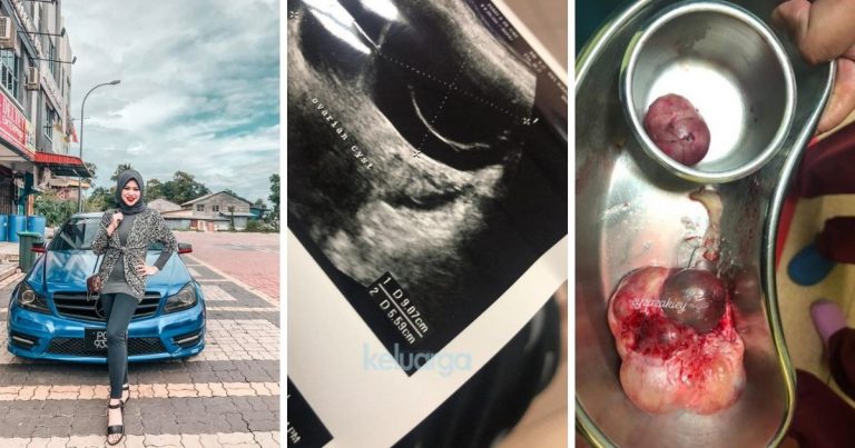 “Pakar Suruh Operate, Detect Cyst Siap Ada Rambut.” Disangka Badan Berangin, Rupanya Ada dua Ketul Cyst. Wanita Ni Nasihat Elak Makan Fast Food, Soya & Ayam Cucuk