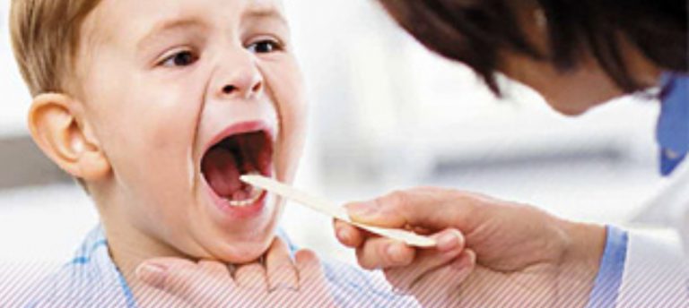 Bila Anak Kerap Sakit Tekak, Mungkin Tanda Masalah Tonsil. Baca Panduan Doktor Ini.
