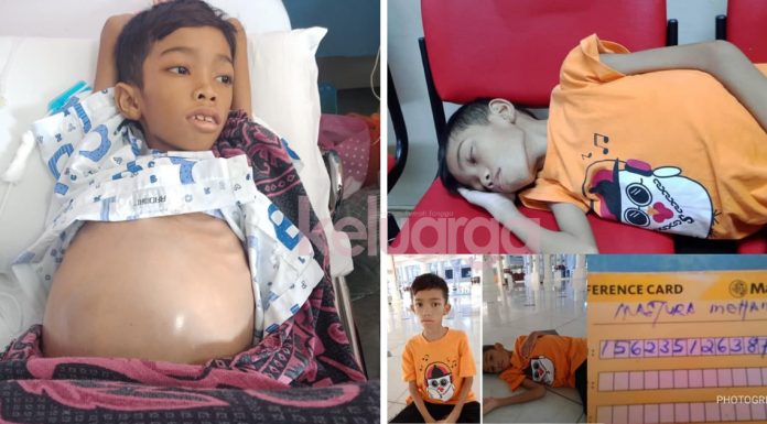 "Perut Makin Membuncit, Derita Komplikasi Pankreas." Ibu ...