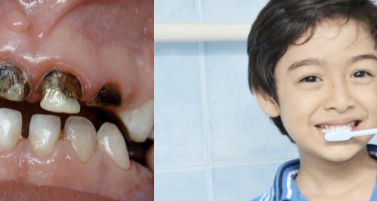 Sebelum Gigi Rosak, Latih Anak Berus Gigi Setiap Hari. Doktor Ini Jelaskan Sebabnya.