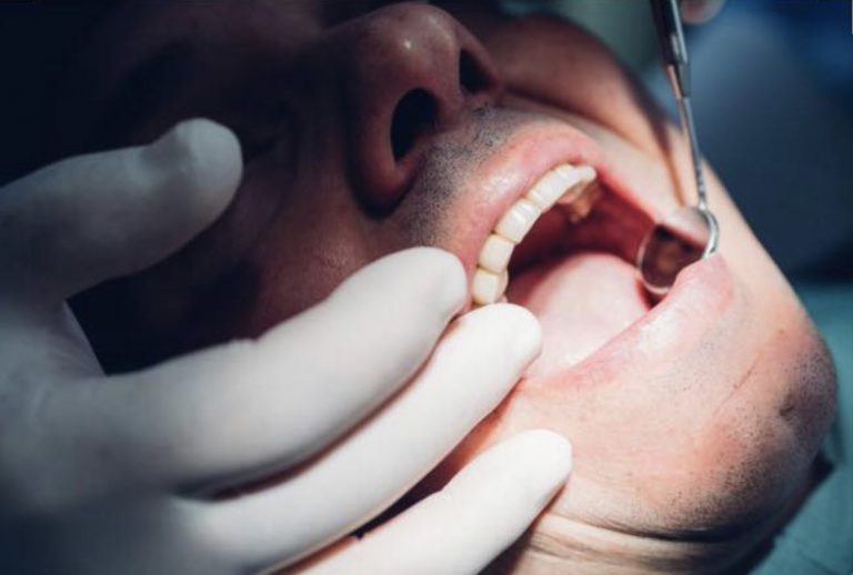 Ambil Perhatian Jika Ulser Dalam Mulut Tak Sembuh. Doktor Ini Jelaskan Sebabnya.