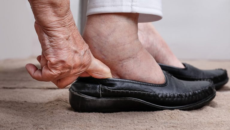 Bila Orang Tua Sering Terkena Bengkak Kaki, Dr Ni Beri Penjelasan Padu!