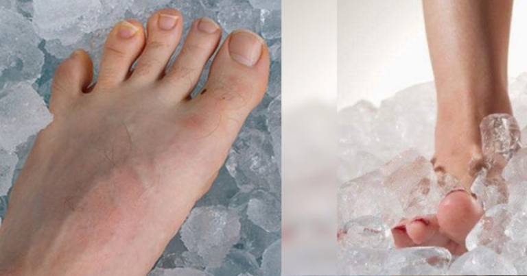 Amalkan Rendam Kaki Dalam Ais Supaya Atasi Sakit Kepala, Sukar Tidur Dan Sakit Badan Serta Gangguan Makhluk Halus.