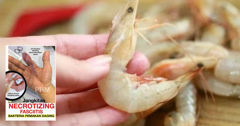 Jari Tercucuk Ketika Siang Udang/Ikan. Jangan Pandang Ringan, Kuman Pemakan Daging Boleh Ragut Nyawa!
