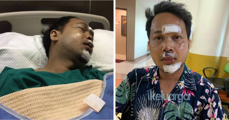 “Ujian Tanpa Diduga. Kun Faya Kun.” Fedtri Yahya Kongsi Perkembangan Terbaru, Warganet Titip Doa!