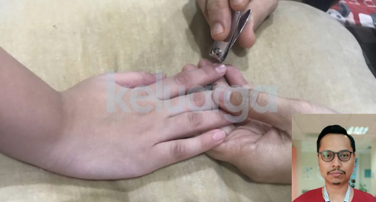 Isi Kuku Bernanah Dan Busuk, Bila Salah Cara Potong Kuku, Boleh Kena Cagu. Alert Info Ini.