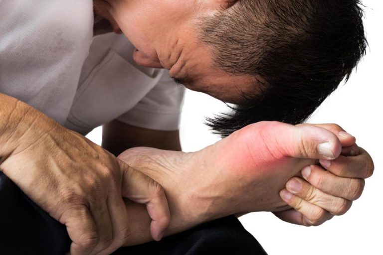Sakitnya Bila Kena Gout! Dr Ini Jelaskan Lanjut Sebabnya, Take Note Semua!