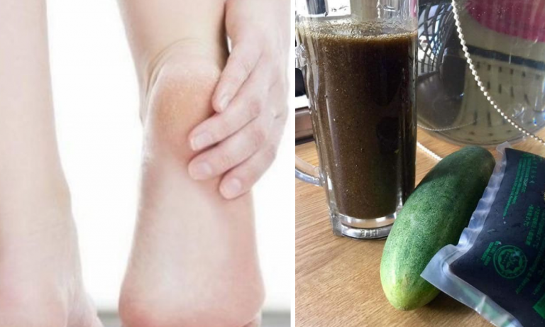 Tumit Kaki Terasa Mencucuk, Petanda Aliran Darah Tak Lancar. Redakan Dengan Amal Minum Jus Macam Wanita Ni Buat!