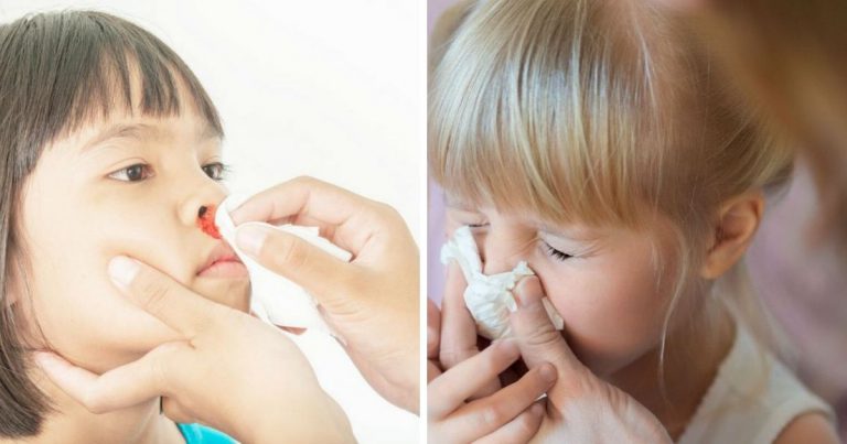 Anak Asyik Hidung Berdarah Bukan Petanda Penyakit Serius. Dr Ini Jelaskan Sebabnya. Take Note Semua!