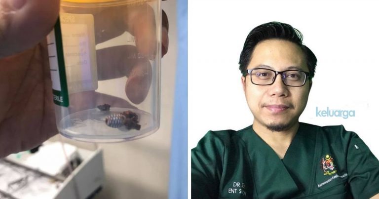 Hidung Berdarah, Bau Busuk, Rupanya Bukan Masalah Resdung, Doktor Ini Beri Nasihat.