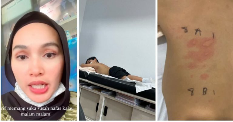 Alergi Debu Penyebab Anak Susah Bernafas & Badan Naik Bintik-Bintik. Tya Kongsi Cerita Jadikan Panduan!