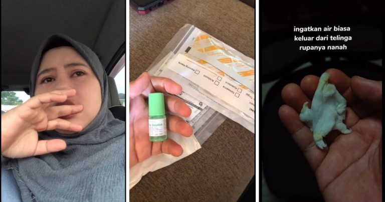 “Lepas Mandi Mesti Guna ‘Cotton Bud’ ..”- Wanita Ni Menangis Kongsi Cerita Gegendang Telinga Pecah!