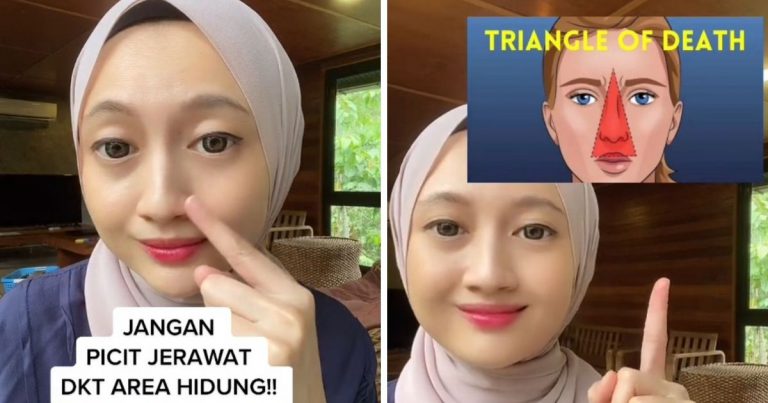 Picit Jerawat Di Hidung Boleh Bahayakan Otak. Dr Ni Bagi Pesan, Agar Jangan Dibuat!