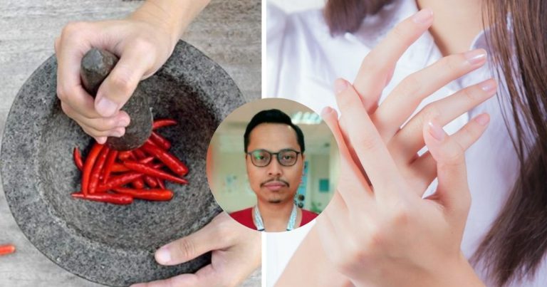 “Kesilapan Utama Hanya Cuci Dengan Air…”- Dr Ni Bagi Cara Betul Nak Hilangkan Pijar Selepas Menyambal!