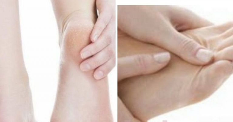 Kaki Sakit Nak Memijak Setiap Pagi, Biasakan 7 Cara Ni Untuk Legakan!