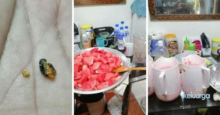 Lelaki Ini Kongsi Petua Rawat Batu Karang Guna Buah Tembikai, Tak Sampai 3 Hari Dah Keluar!
