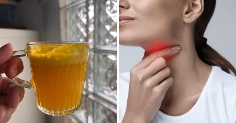 Batuk Berkahak, Nak Cairkan Segera Amal Minum Air Kunyit Ni!