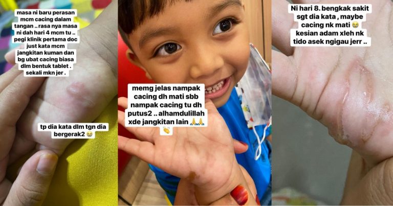 Anak Mengadu Ada ‘Benda’ Bergerak Dalam Tangan, Rupanya Cacing! Hati-Hati Bagi Anak Main Pasir