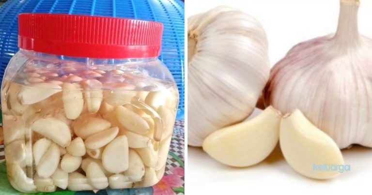 Amal Selalu Makan Bawang Putih, Bantu Turunkan Kolestrol. Ini Cara Nak Buat Jeruk, Banyak Khasiatnya!
