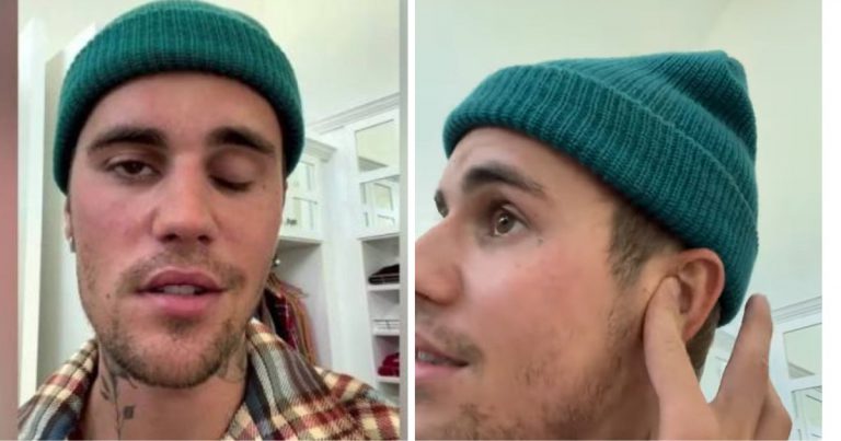 Justin Bieber Batal Konsert, Alami ‘Kelumpuhan Muka’!