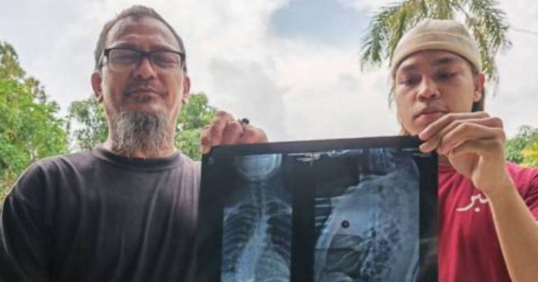Ayah Runsing Cari Baki Kos RM13, 370 Untuk Pembedahan Anak, Rusuk Kian Himpit Ke Jantung!