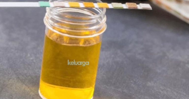 Ramai Usia 20an Sudah Rosak Buah Pinggang, Pakar Ini Nasihat Buat Saringan Segera