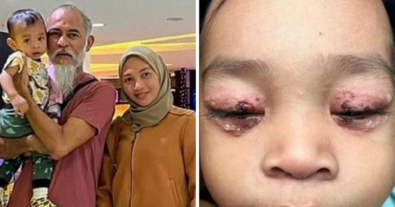 “Bila Air Pecah Dan Nampak Darah..”-Mata Anak Aman Graseka Dijangkiti Virus, Perlukan Bantuan Untuk Rawatan!