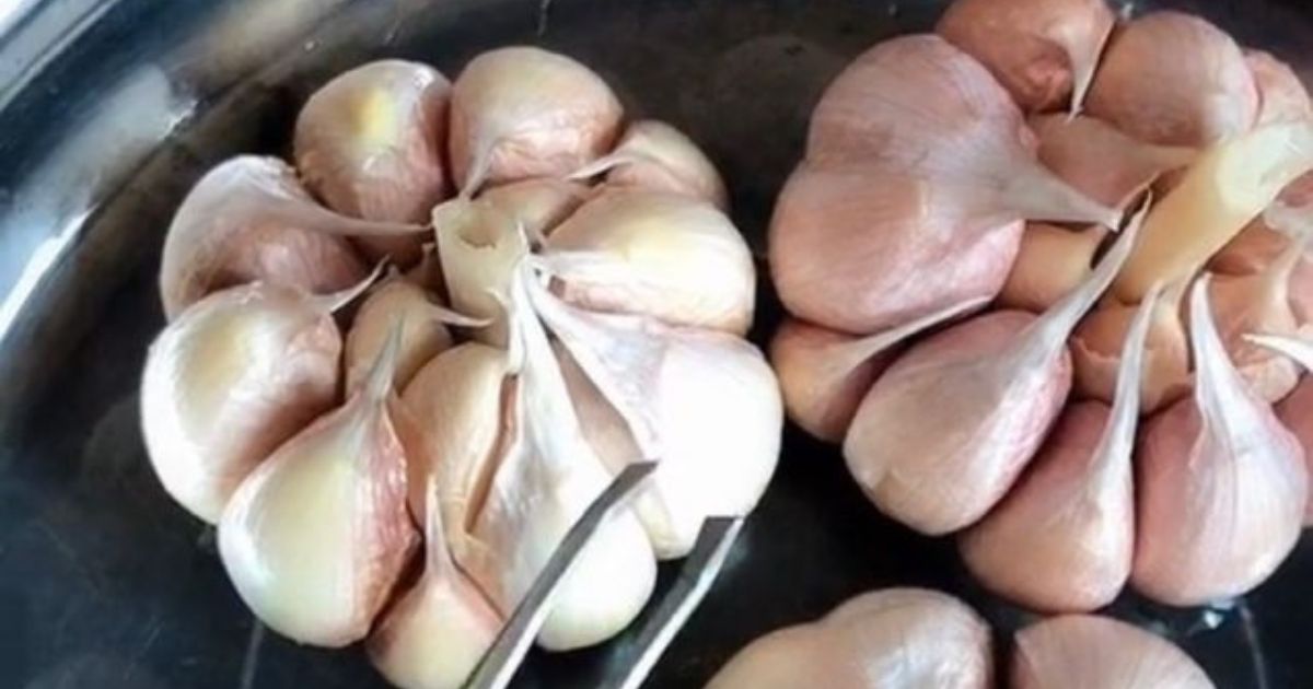 Bersin Tak Berhenti, Pakar Otak Kongsi Petua Mudah Redakan, Guna Bawang Putih!