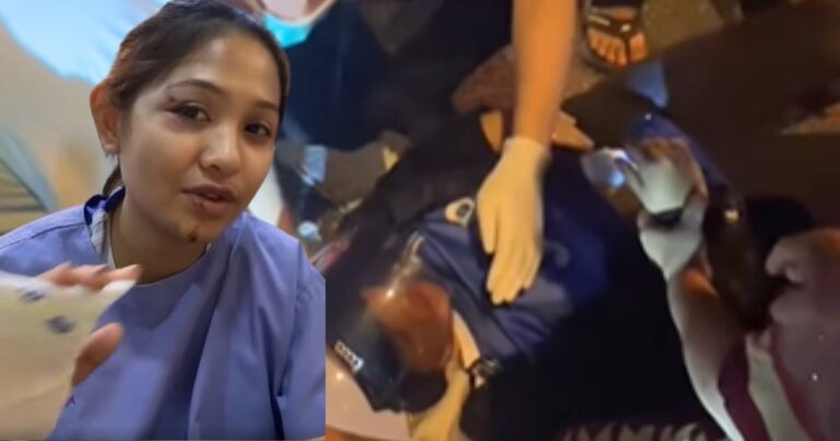 “Patah Jari, Alami Luka” Siti Jamumail Kemalangan, Tercampak Ke Jalan Raya!