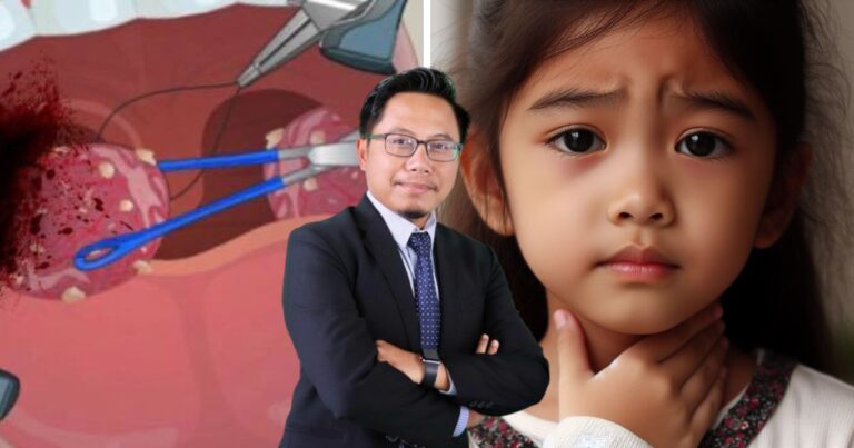 Anak Kerap Sakit Tekak, Perlu Atau Tak Jalani Pembedahan