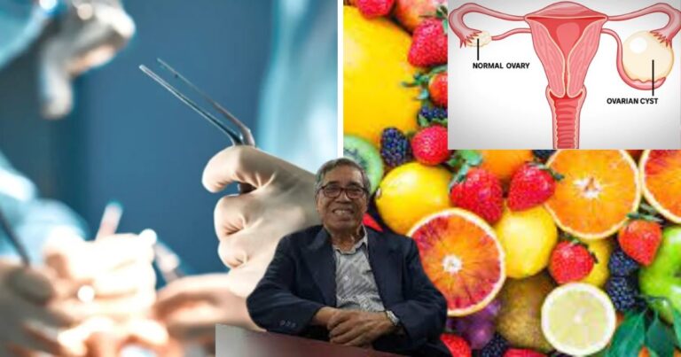 Dr Senarai Makanan Bantu Kecutkan Cyst & Fibroid