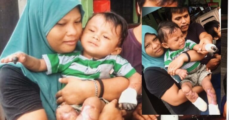 Jari Bertukar Hitam, Tunggu Masa Kena Potong, Mak Ayah Reda Anak Menderita Penyakit Gangrene!