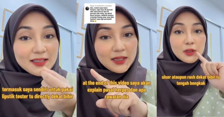 Suka Cuba ‘Tester’ Gincu Di Bibir, Doktor Jelaskan Tabiat Ni Antara Faktor Jangkitan Herpes